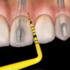 SONDA COLORVUE NORTE CAROLINA,PCVNCKIT12,12PTAS.+2MAN,HU-F - Imagen 4